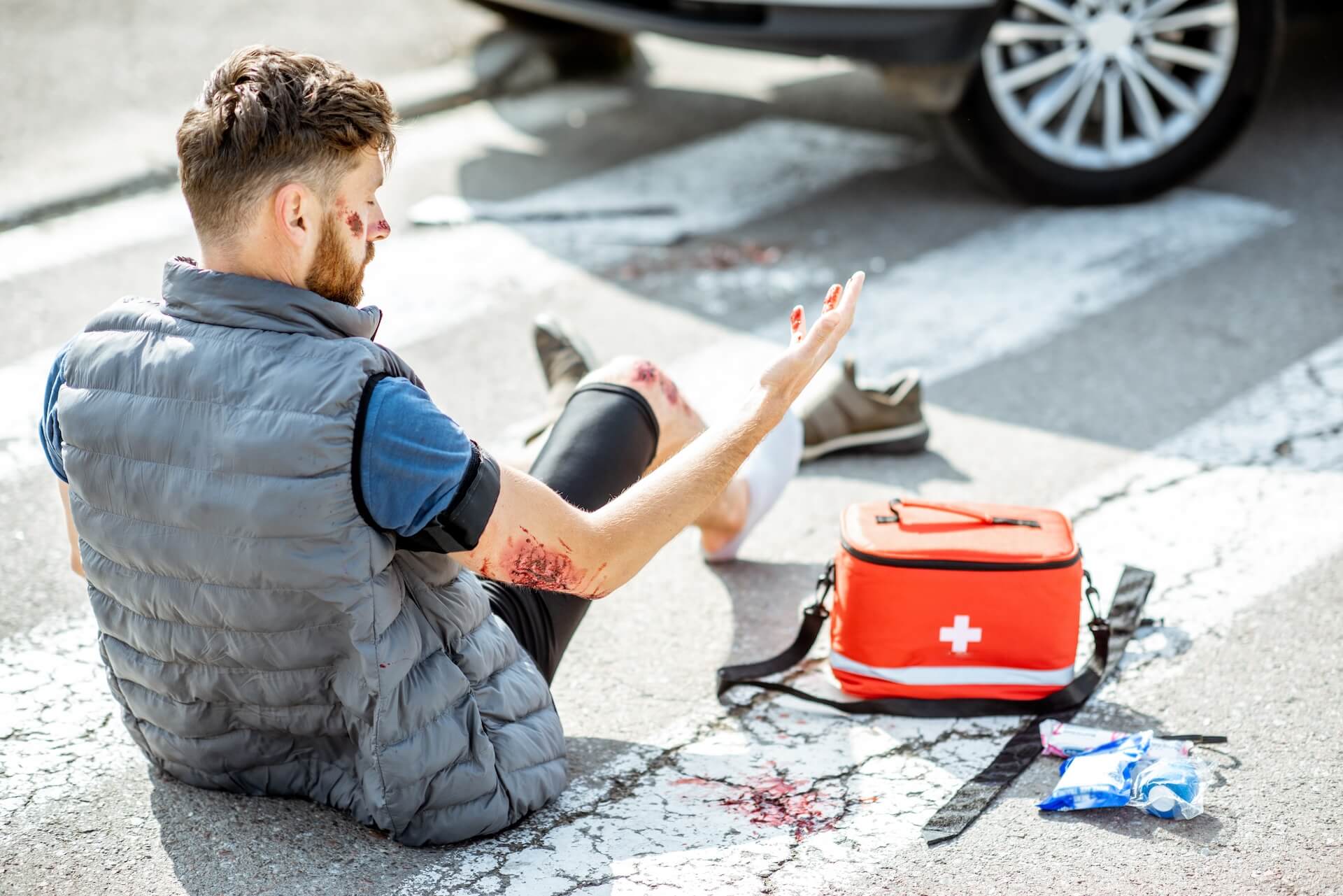 injured man after the road accident